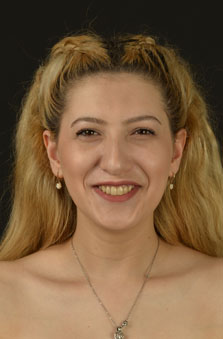 Bayan Fotomodel - Zlal Ylmazlar