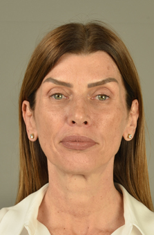 Bayan Fotomodel - zlem Acar