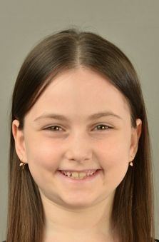 Bayan Cast - Masal Keskiner